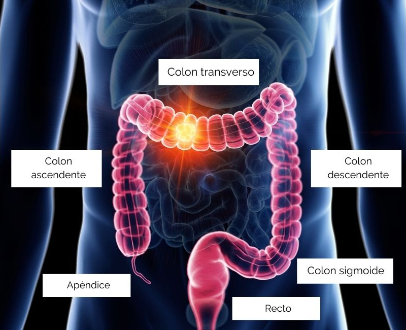 Últimos Avances En El Tratamiento Del Cáncer De Colon Y Recto | Blog De ...