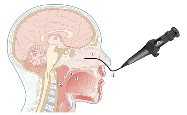 nose-diagram