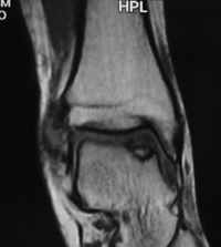 Lesiones-osteo2